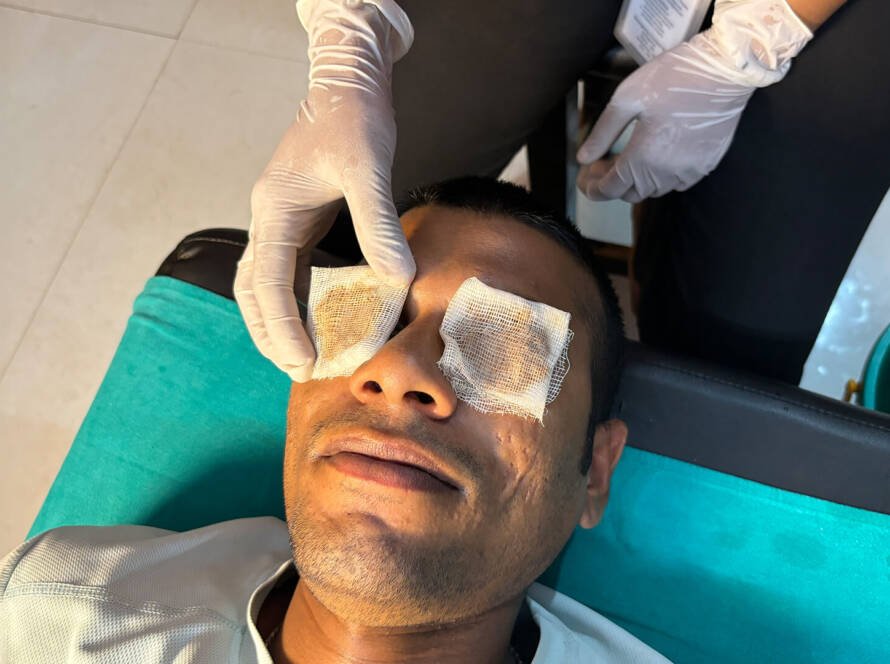 Ayurvedic Eye Treatment in Gurgaon