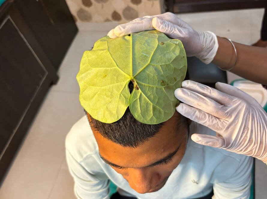 Ayurvedic Eye Treatment in Gurgaon